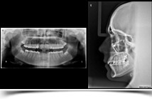 Ortopantomografía y Teleradiografía Digital